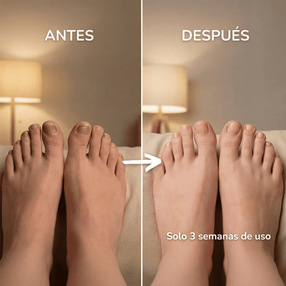 🎁 Pack 2x1 Fungal Nail - Elimina hongos mientras duermes