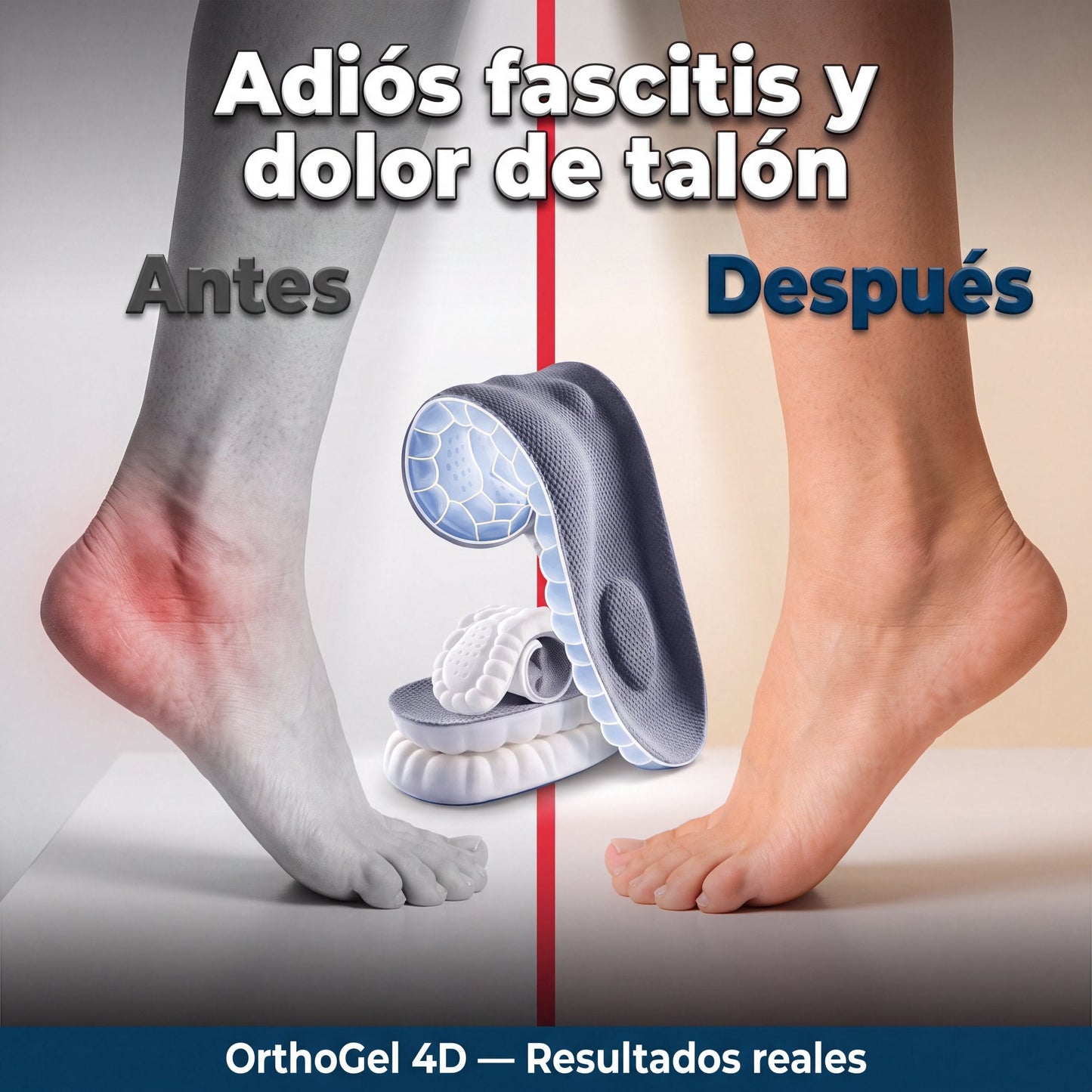 Antes y después dolor de talón