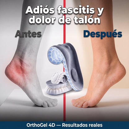 Antes y después dolor de talón
