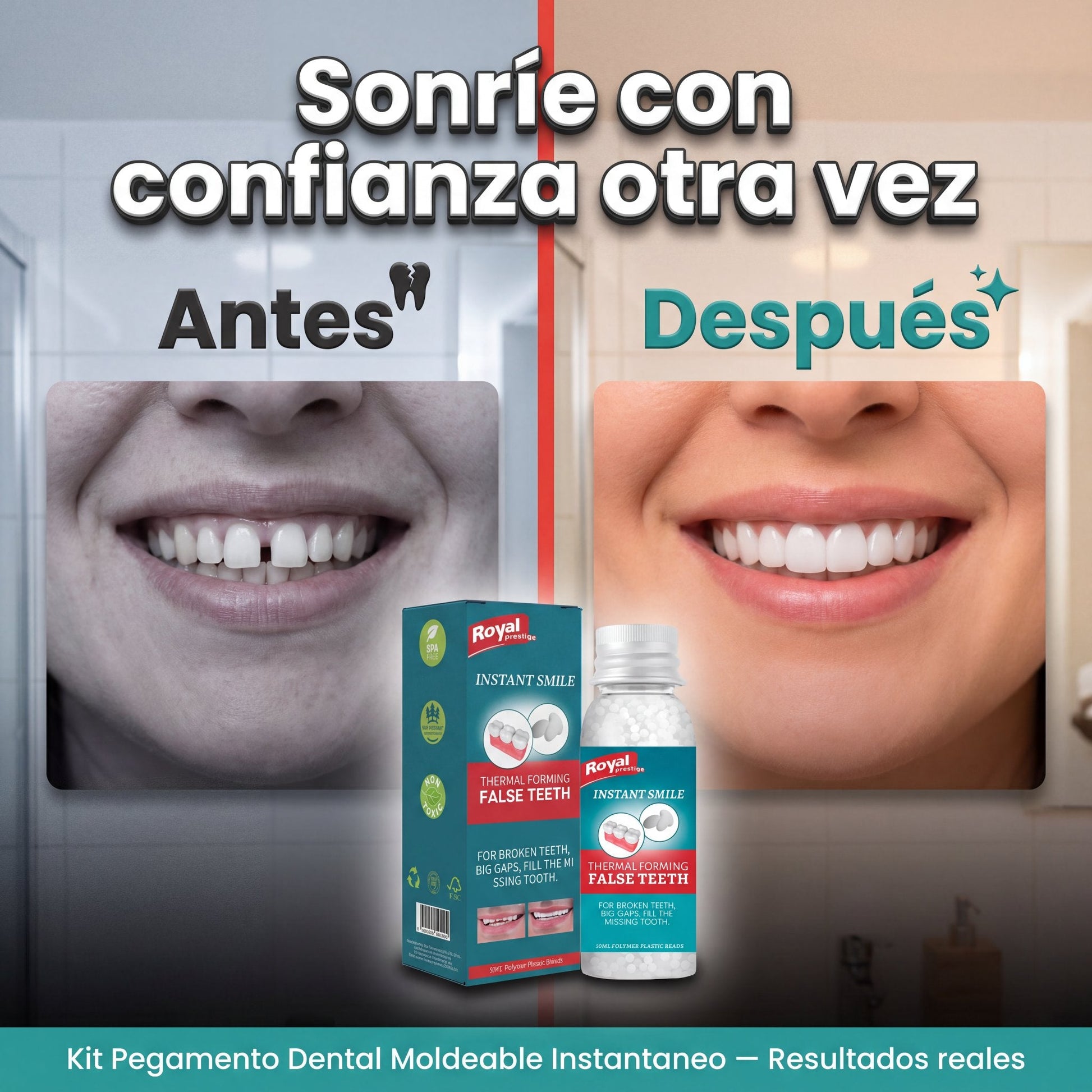 Pegamento Dental - antes y despues